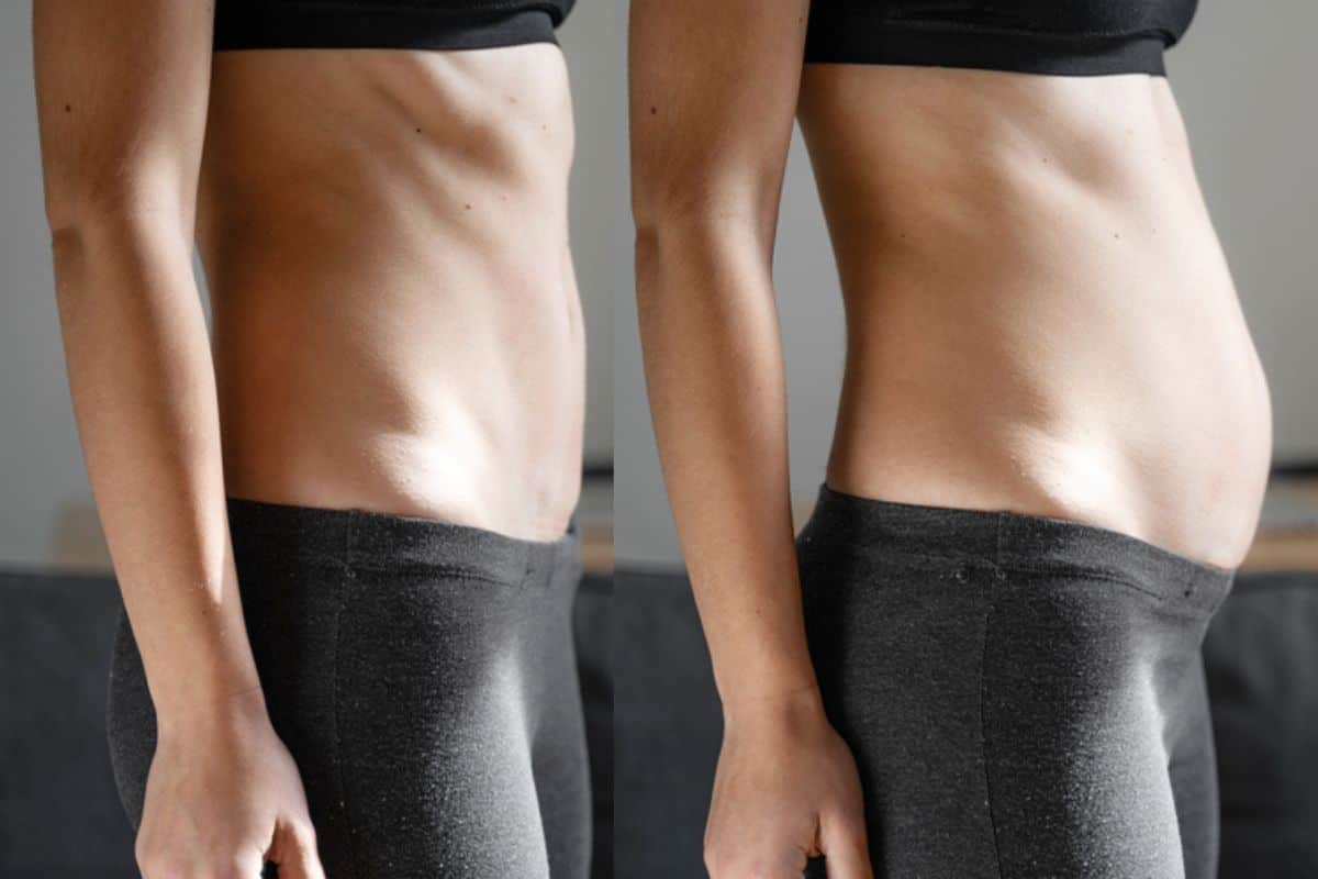 How long does diastasis recti take to improve West Bromwich?