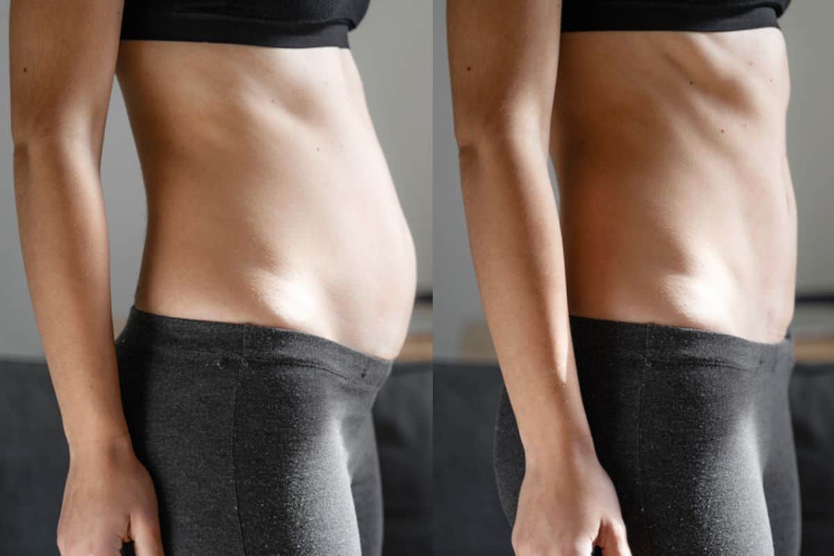 Post-Pregnancy: What Happens to Your Abdominal Muscles After Birth West Bromwich