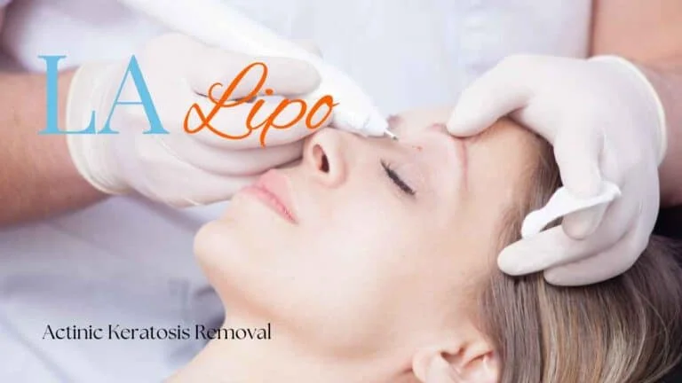 Woman receiving Actinic Keratosis Removal Treatment West Bromwich