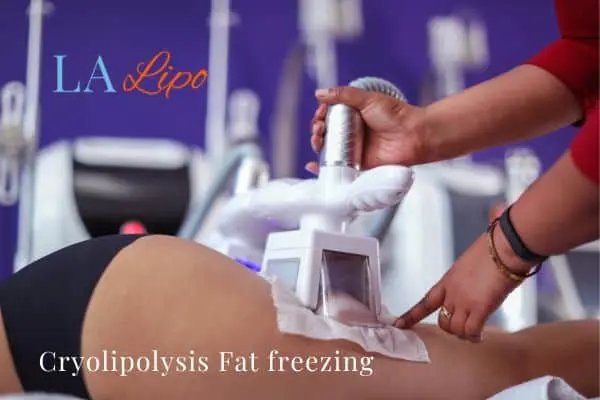 women getting fat freezing West Bromwich