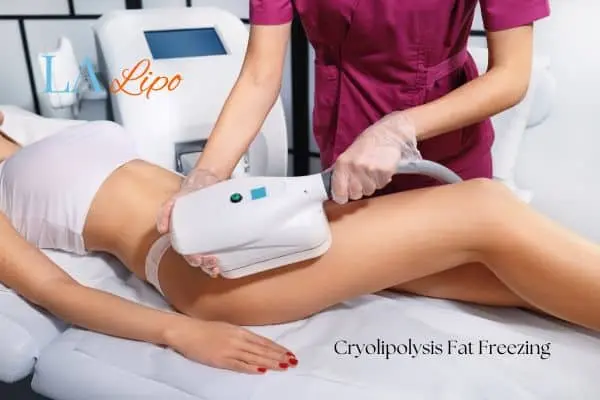 Woman receiving coolsculpting West Bromwich treatment on her thighs