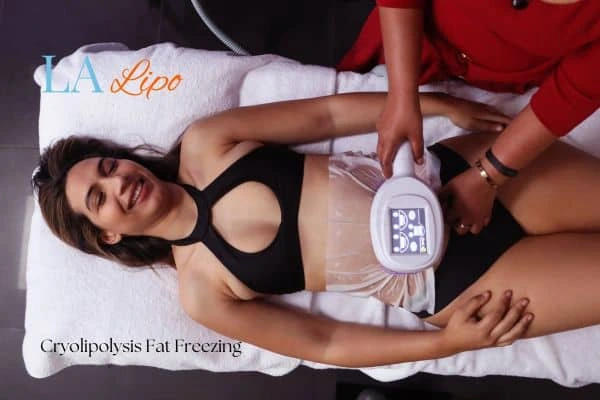 woman getting cryolipolysis West Bromwich