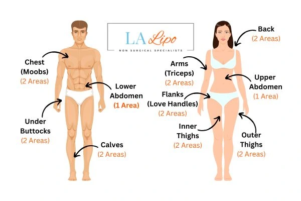 LA LIPO Cryolipolysis Areas West Bromwich