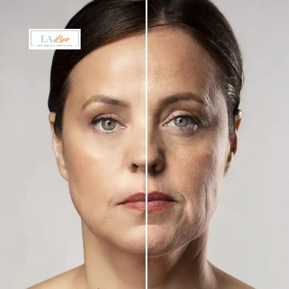 How Can You Tell If Non-Surgical Skin Tightening Is Right for You West Bromwich?