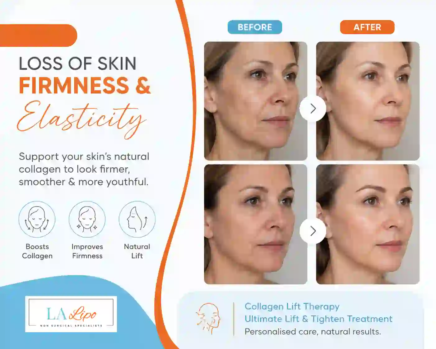 Sign #7: Loss of Skin Firmness and Elasticity West Bromwich